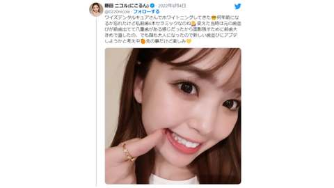 【芸能】藤田ニコル「歯並び炎上ネタ」をあえて持ち出した「覚悟を決めた」言い分